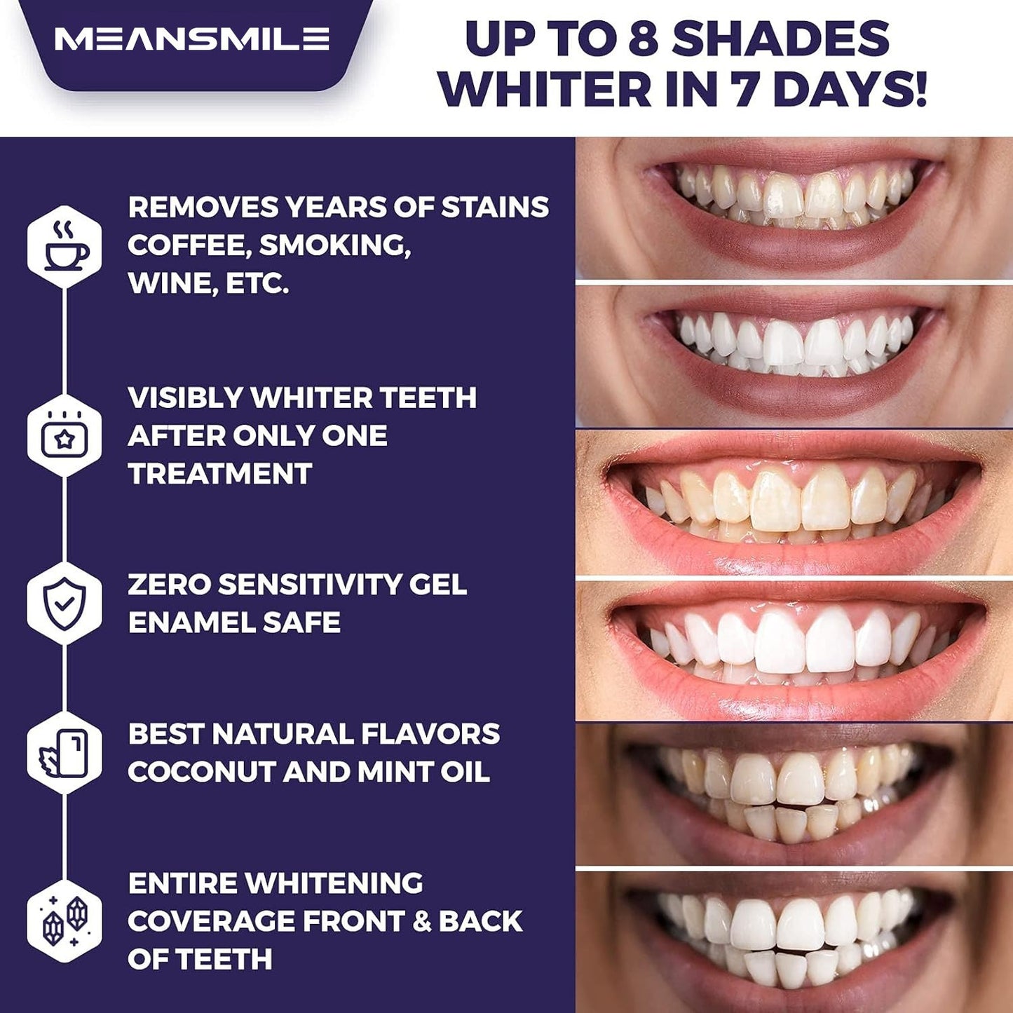 Teeth Whitening Strips | Brighten Your Smile Effortlessly