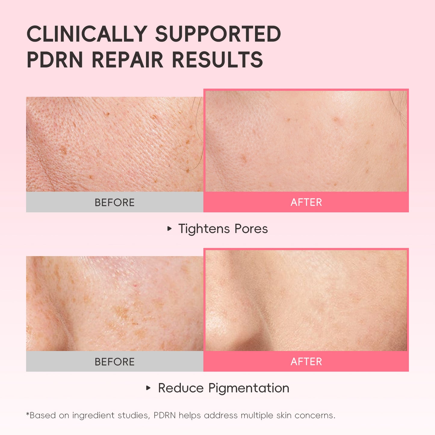 Hydrating Centella Asiatica Essence | Deep Moisturizing Serum