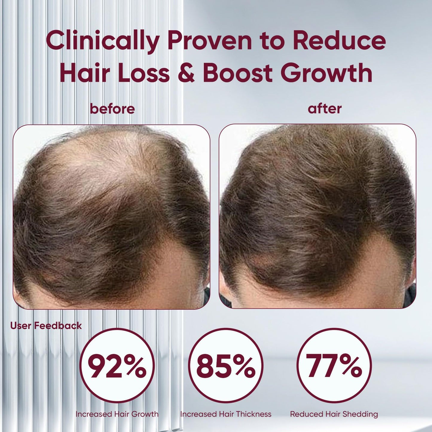 Volumizing Hair Shampoo with Red Onion Extract | Free Shipping