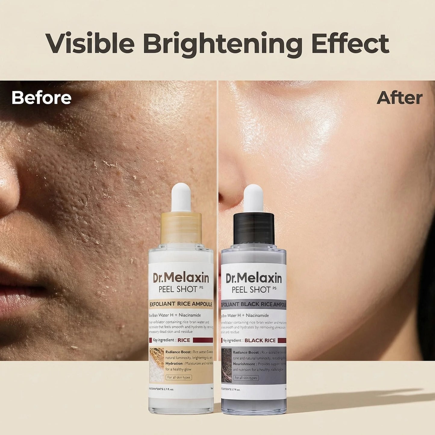 Black Rice Exfoliating Ampoule | AHA BHA Face Serum for All Skin Types