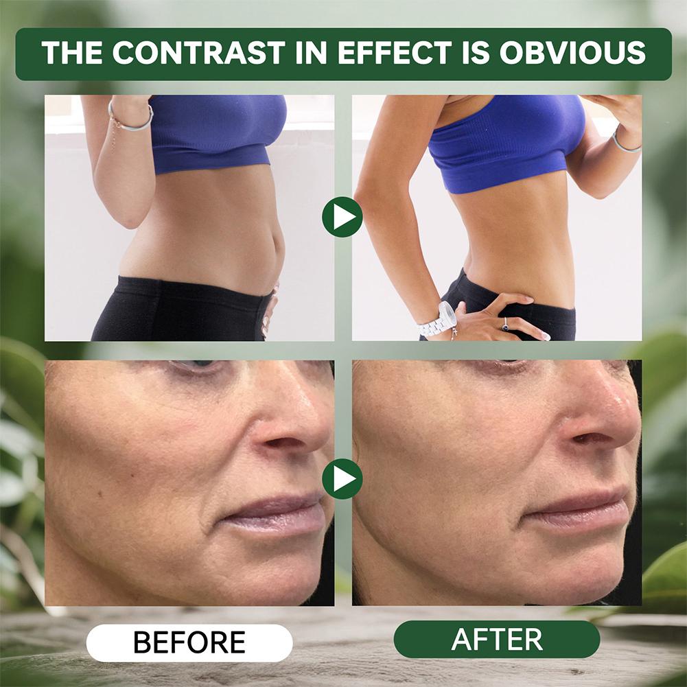 Advanced Nano Microneedle Patch for Body Skin Care