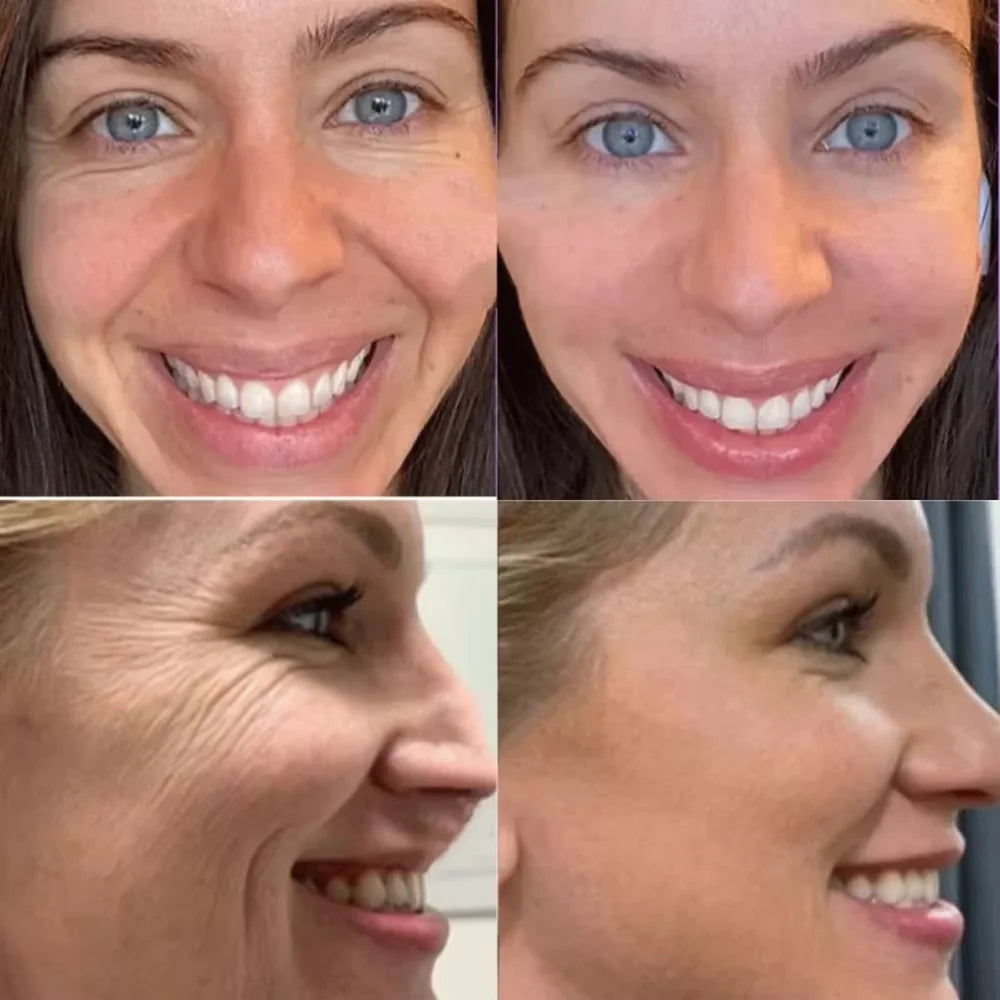 Collagen Anti-Wrinkle Facial Mask | Hydrating Skin Care Solution