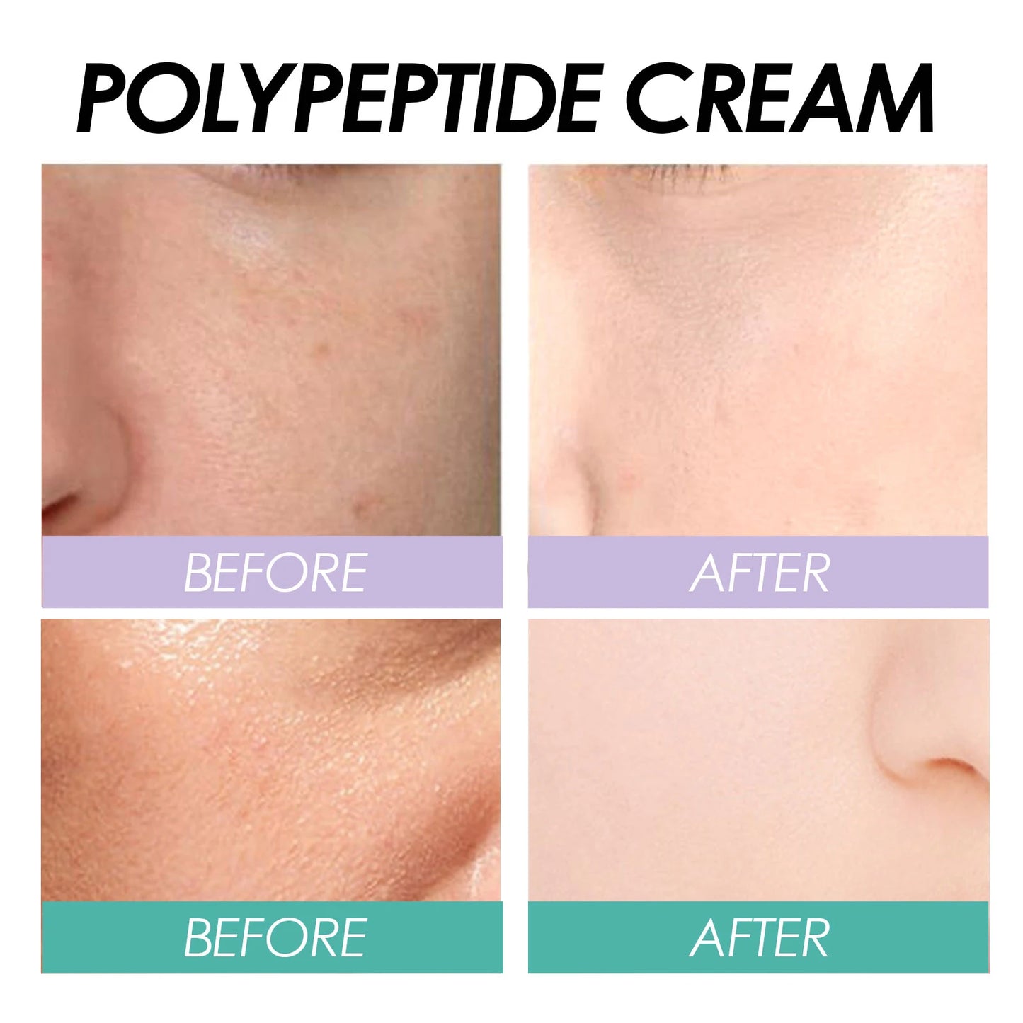 Whitening Freckle Removal Essence | Brightening Skin Care Cream