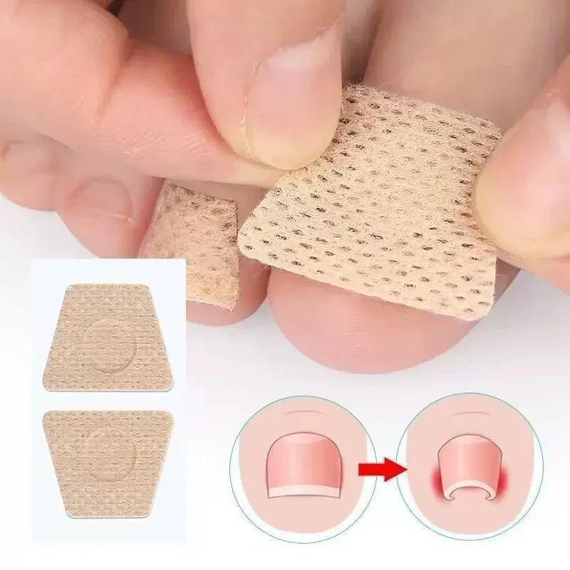 Toenail Fungus Repair Patches | Nail Care for Discolored Nails