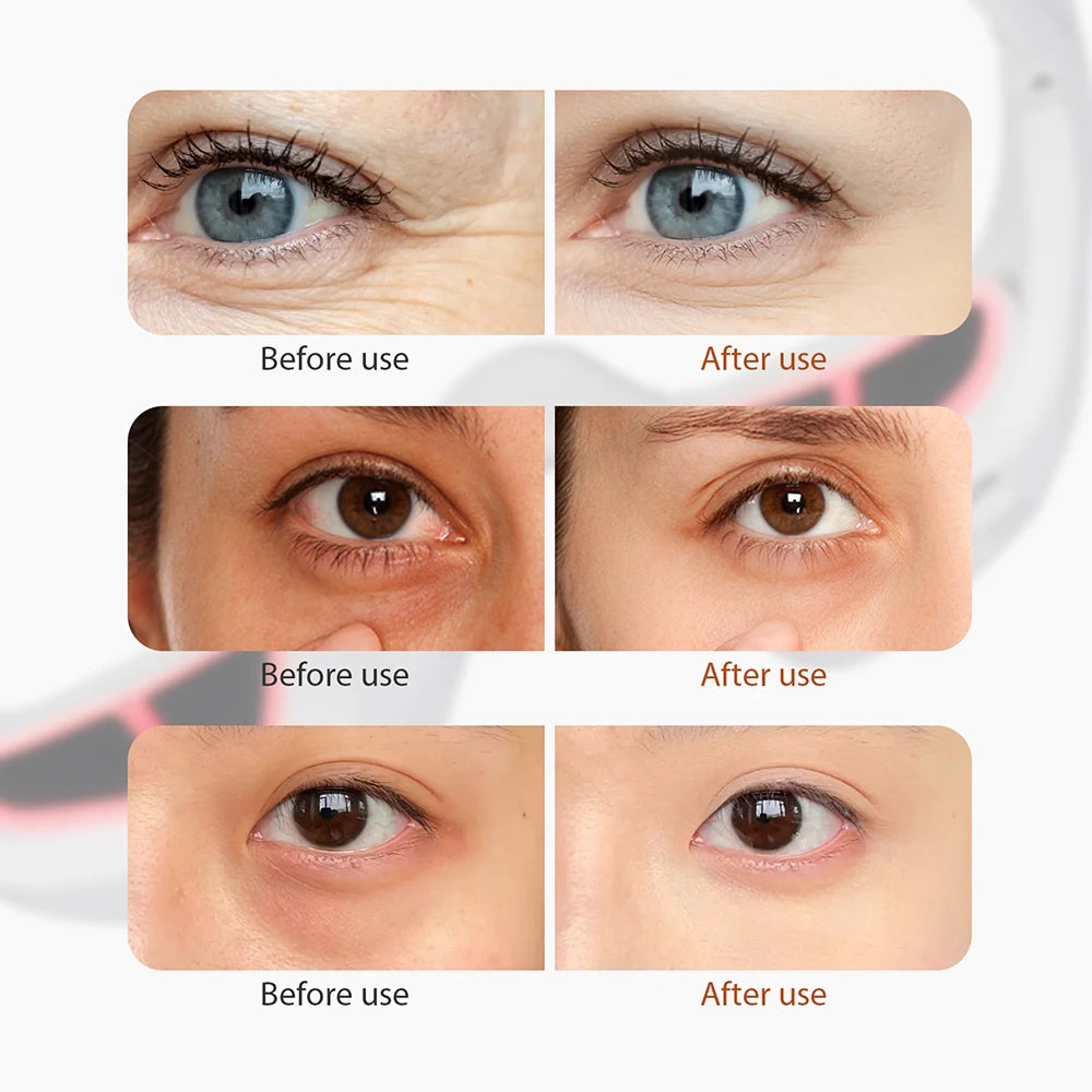 Eye Fatigue Relief Massager Glasses | Soothing Under-Eye Treatment
