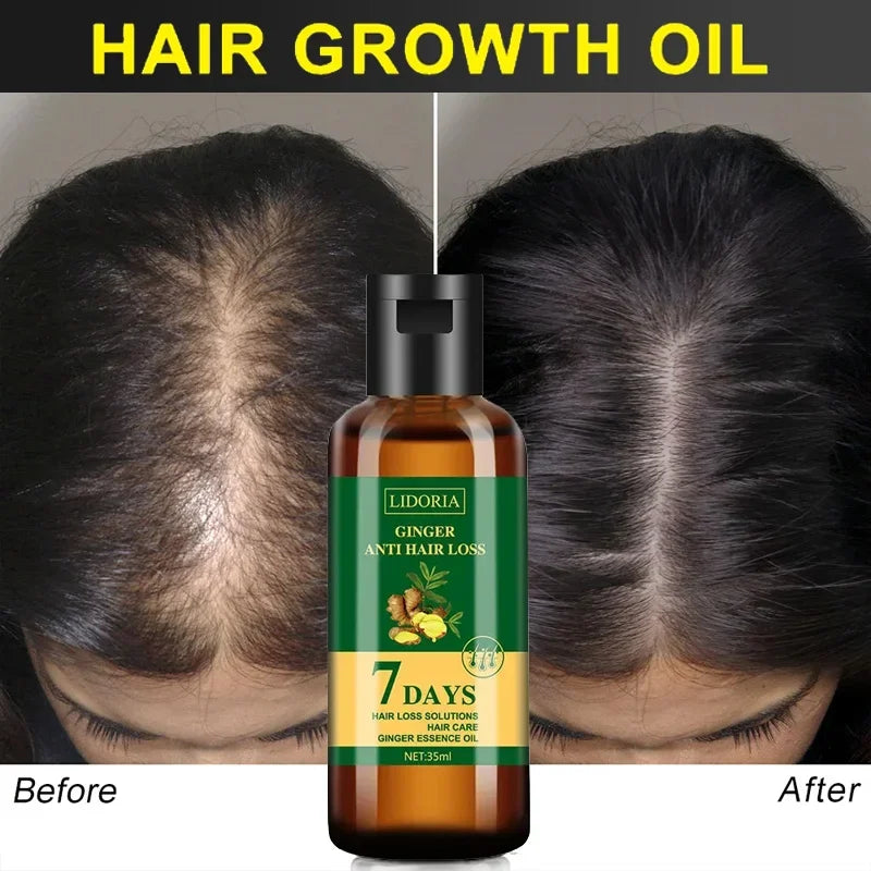Ginger Hair Growth Essential Oil | Anti-loss Regrowth Serum