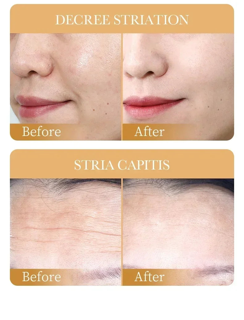 10pcs Collagen Anti-Aging Face Masks | Moisturizing & Revitalizing