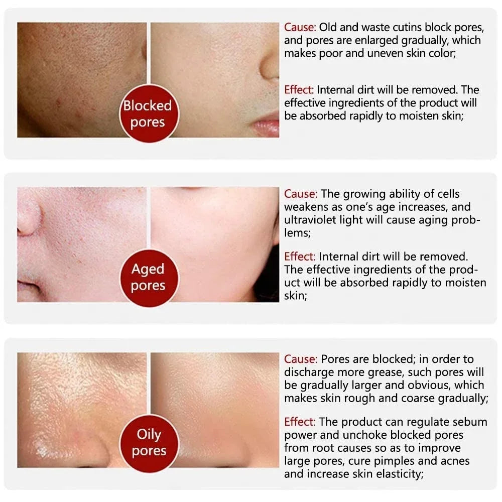 Pore Refining Resurfacing Serum | Brightening Facial Elixir