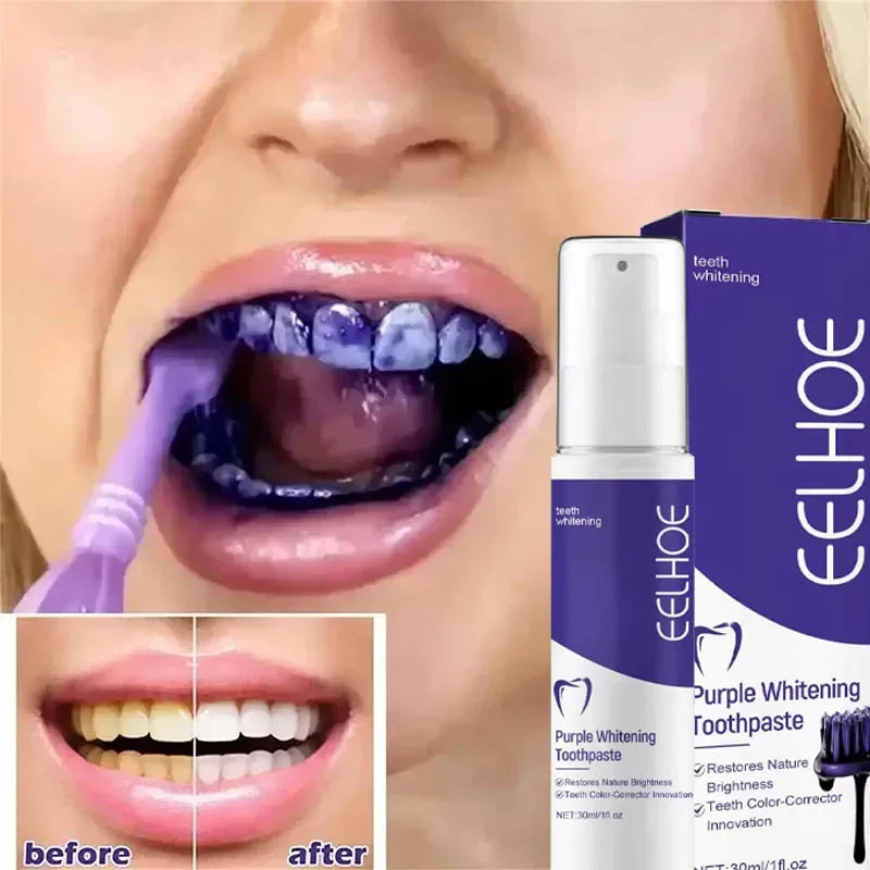 Bestselling Whitening Toothpaste | Brighten Your Smile Naturally