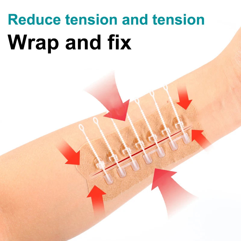 Portable Zipper Tie Wound Closure Patch | Quick Hemostatic Band-Aid
