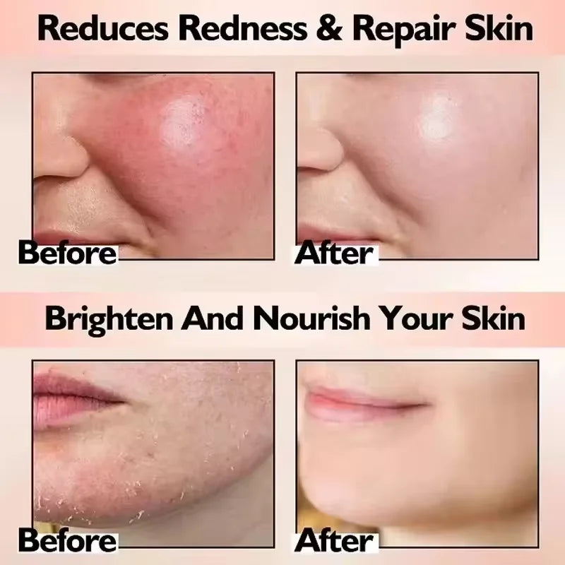 Collagen Anti-Wrinkle Facial Mask | Hydrating Skin Care Solution