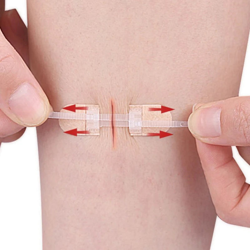Breathable Wound Care Closure Patches | Seamless Elastic Bandages