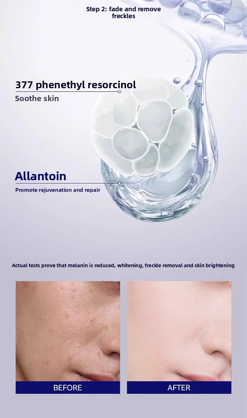 Whitening Freckle Removal Essence | Brightening Skin Care Cream