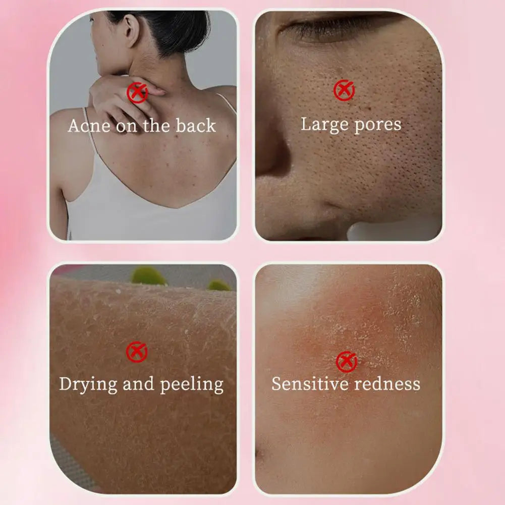 Rose Oil Whitening Soap | Brightening & Nourishing Cleansing Bar