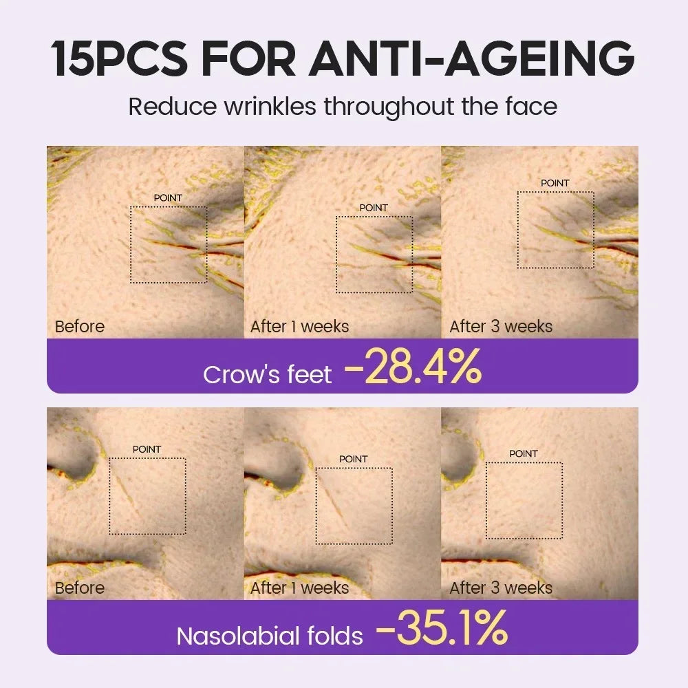 15 Bottles of Retinol + Xylose Precursor Ampoule Essence for Youthful Skin