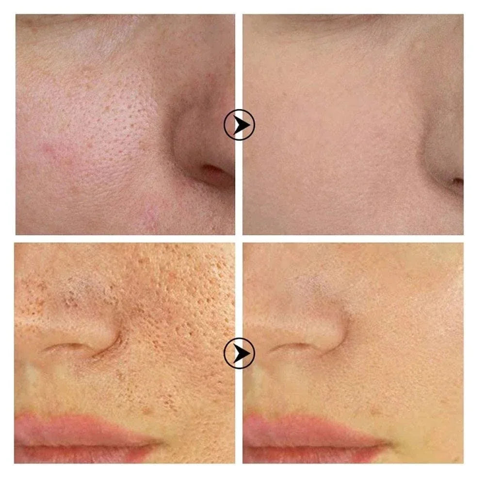 Pore Refining Resurfacing Serum | Brightening Facial Elixir