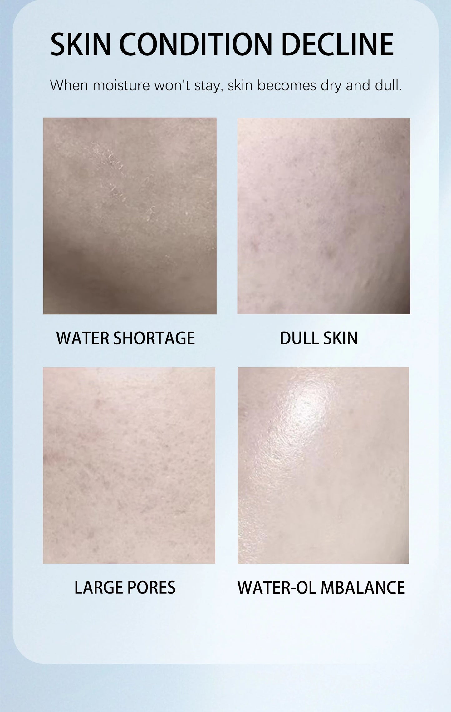 Niacinamide Face Cream | Minimize Pores & Hydrate Oily Skin