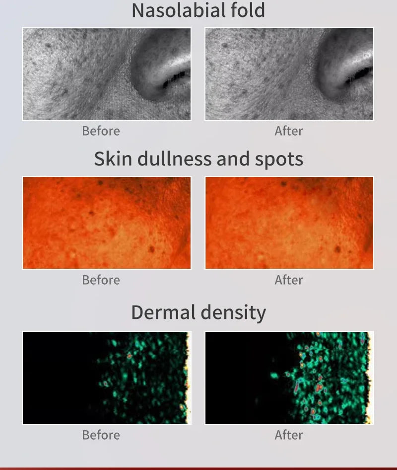 LED Facial Mask for Anti-Aging | Photon Light Therapy Device