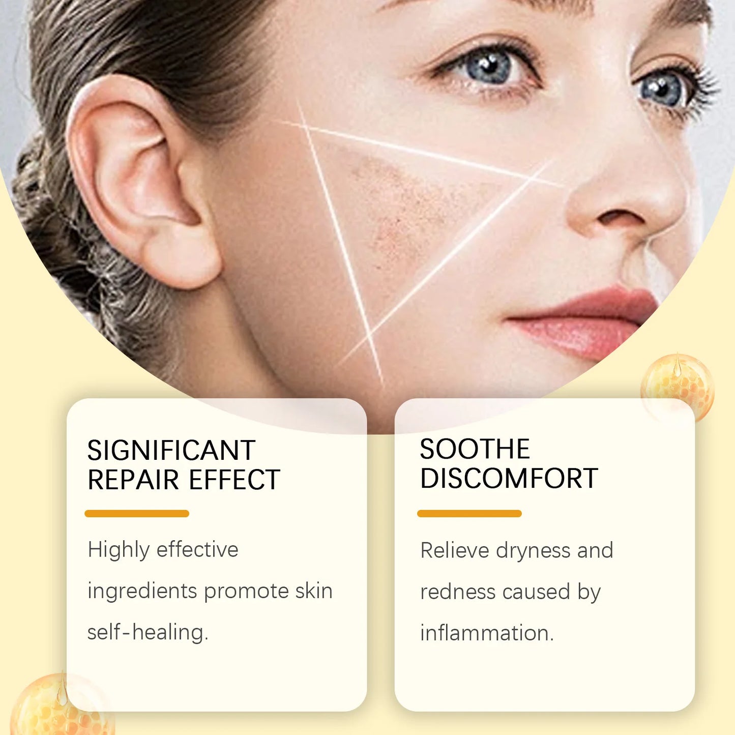 Bee Venom Skin Treatment Cream | Moisturizing & Blemish Remover