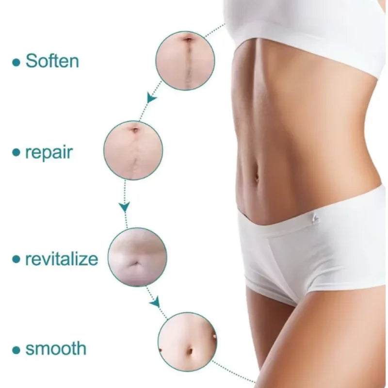 Silicone Scar Removal Strips | Effective Acne & Keloid Treatment