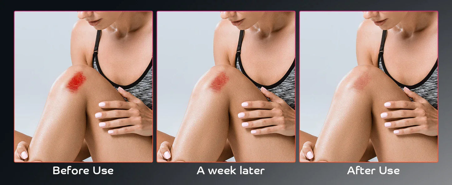 Red Light Therapy Lamp for Pain Relief | Portable LED Torch