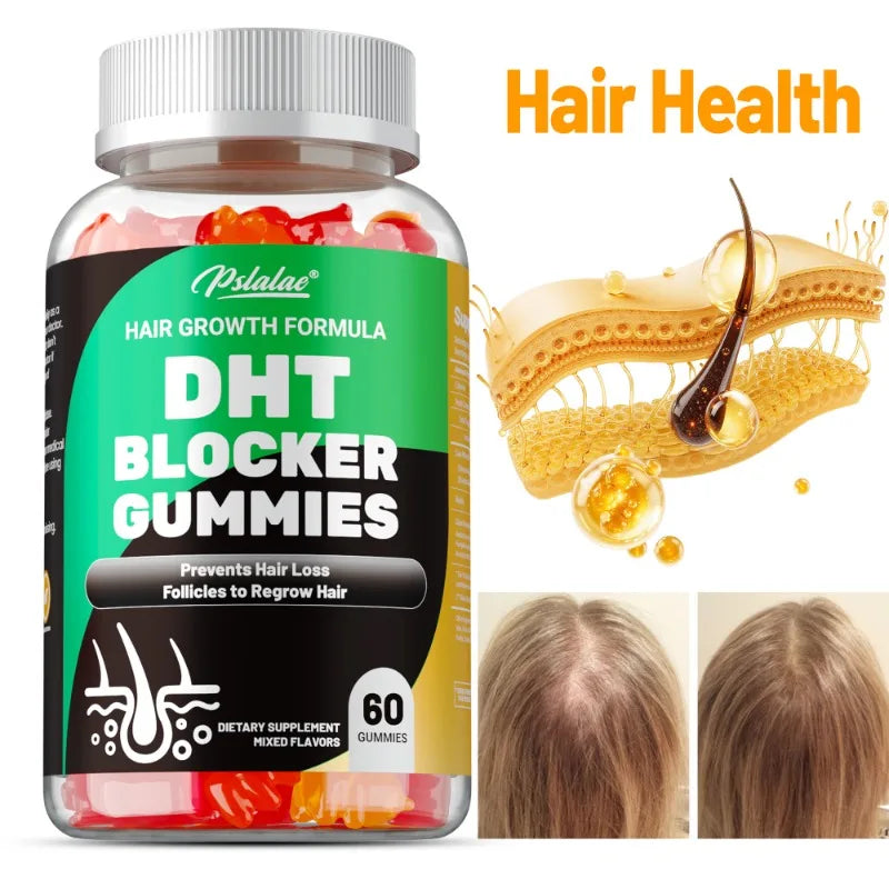 DHT Blocker Gummies for Thinning Hair | Hair Growth Supplement