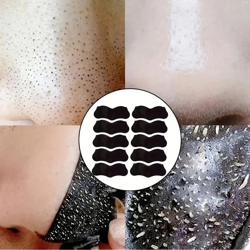 50/100PCS Charcoal Nose Strips for Blackhead Removal & Acne Treatment