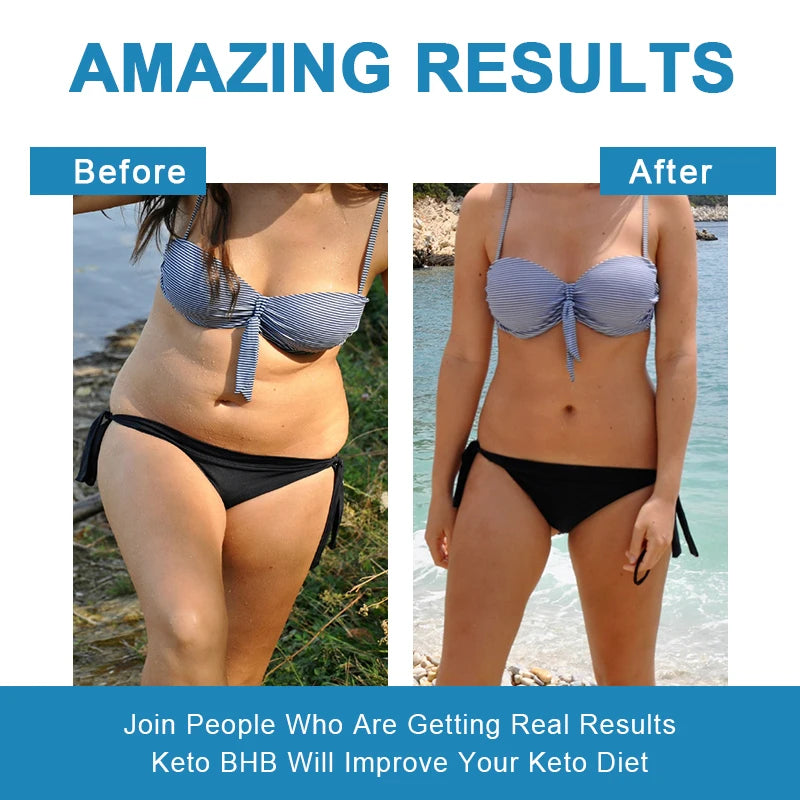 Keto Gummies for Weight Loss | Support Body Shape Management