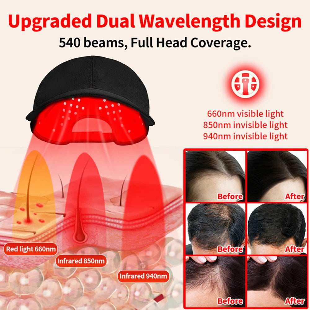 LED Red Light Therapy Hair Growth Hat | Anti Hair Loss Treatment