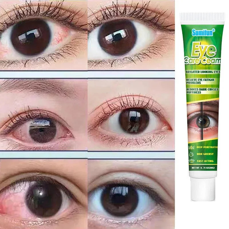 Herbal Eye Care Cream for Dark Circles & Puffiness Relief