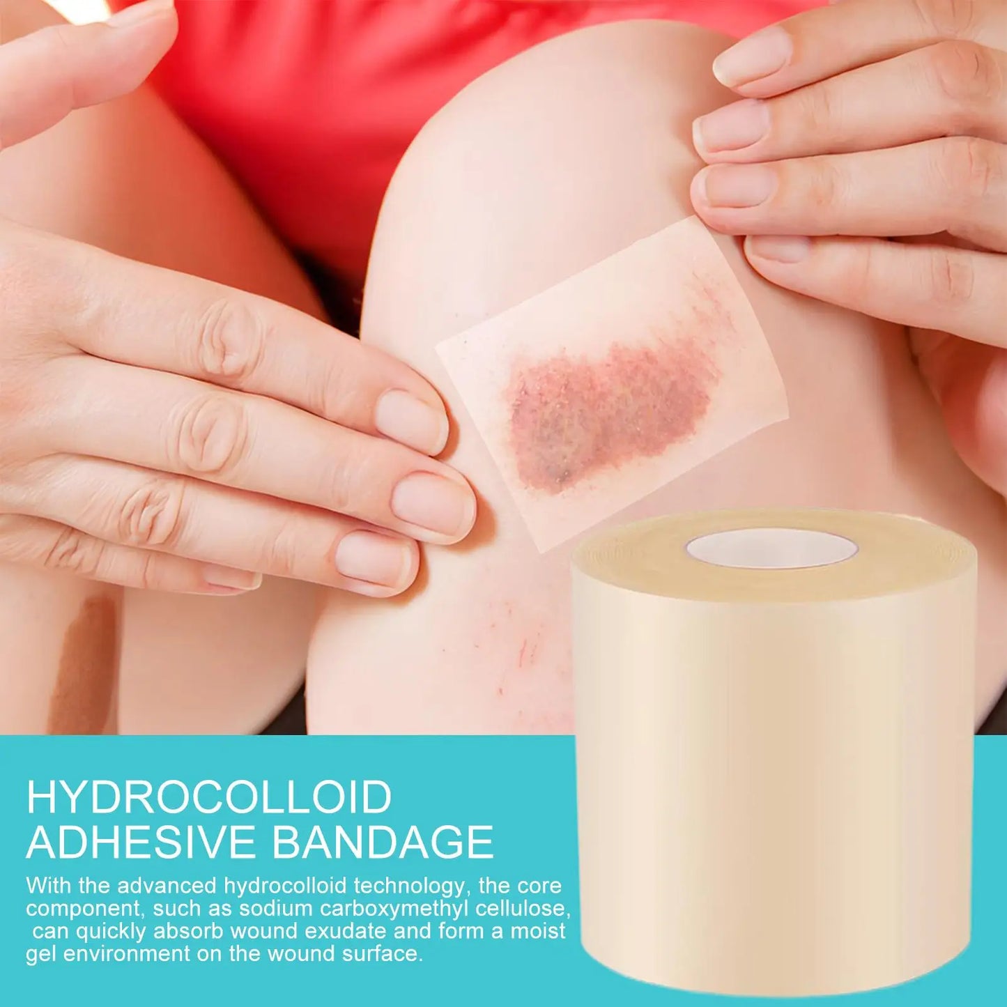 Hydrocolloid Roll Waterproof Pimple Patches | Flexible Skin Dressings