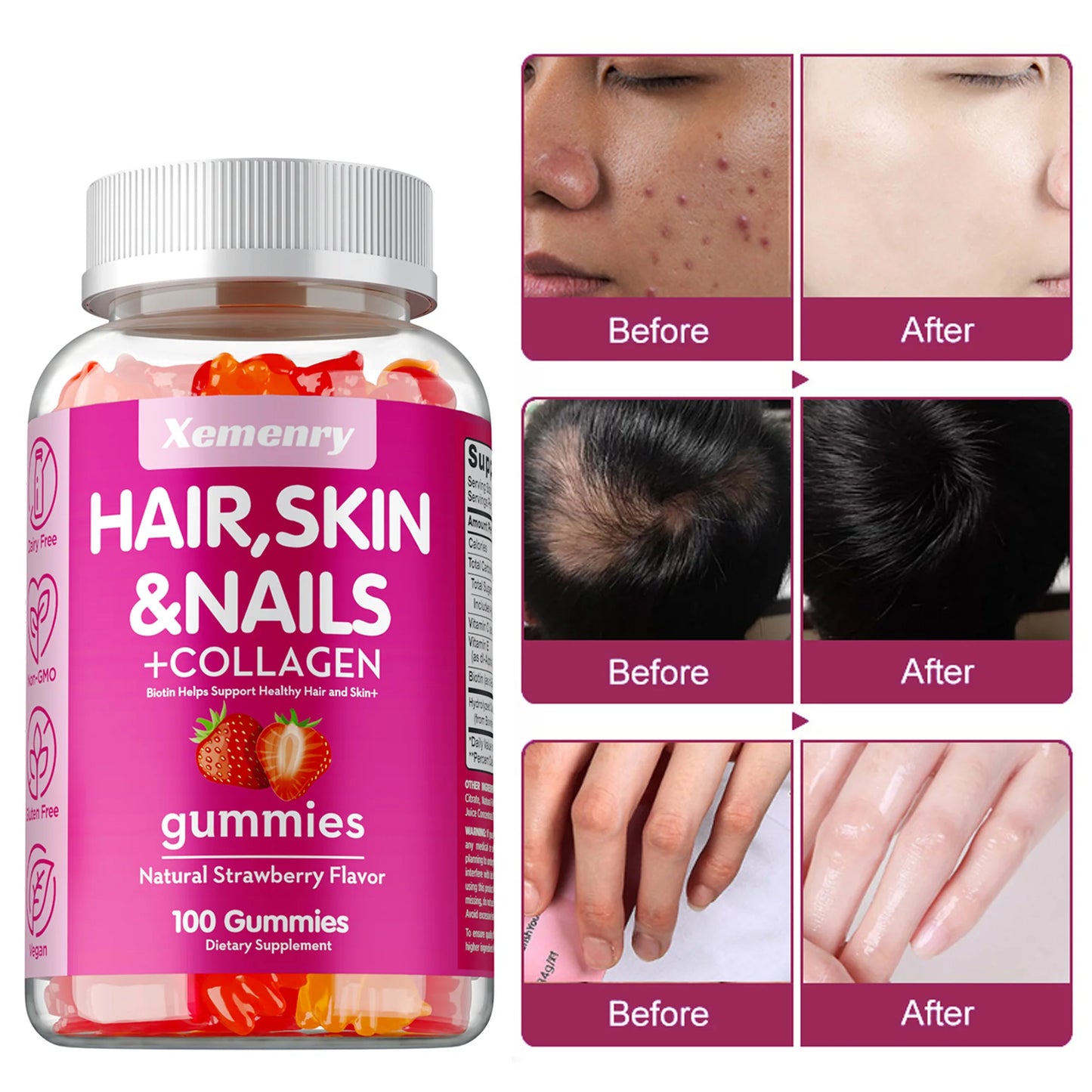 High Potency Biotin Gummies for Healthy Hair, Skin & Nails