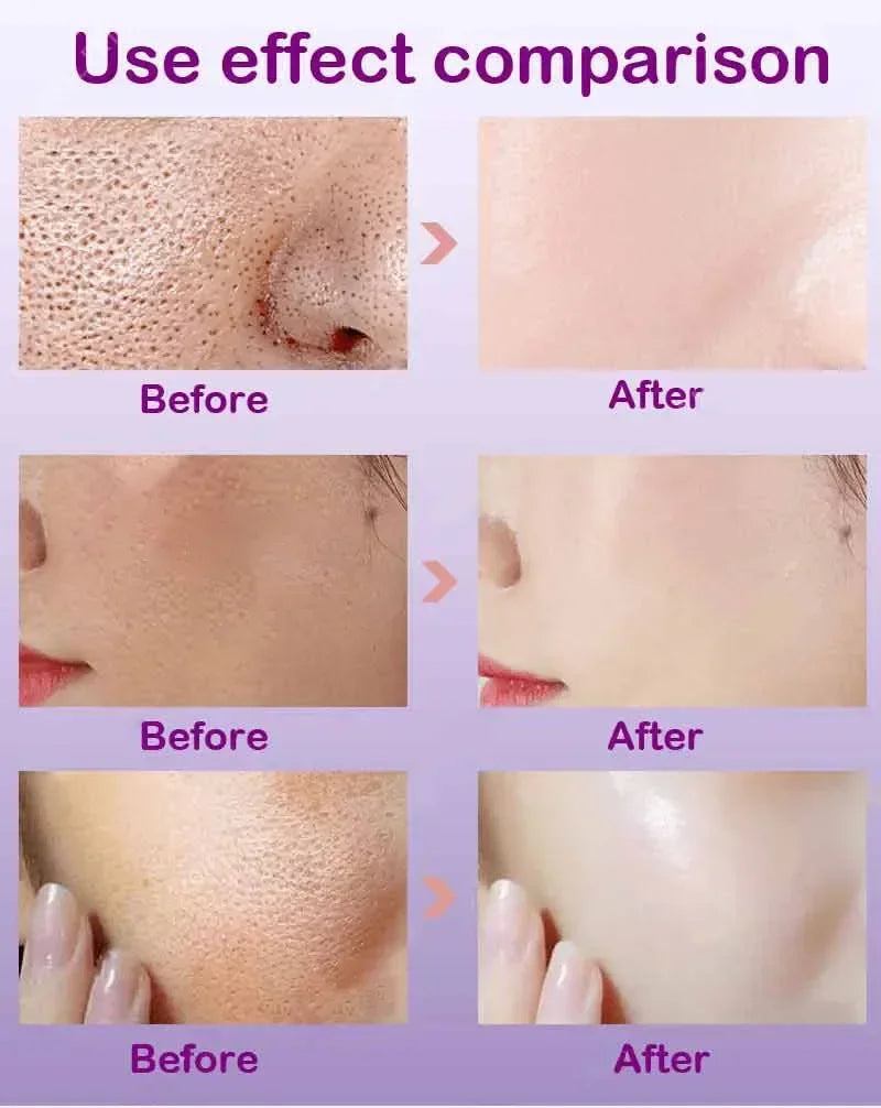 Pore Refining Resurfacing Serum | Brightening Facial Elixir