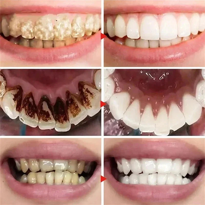 Bestselling Whitening Toothpaste | Brighten Your Smile Naturally