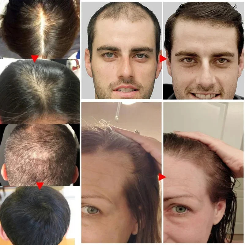 Ginger Hair Growth Essential Oil | Anti-loss Regrowth Serum