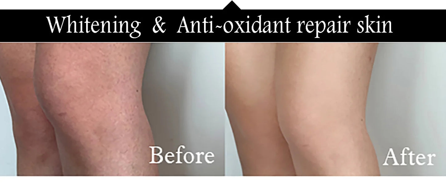 Whitening Body Lotion for Dark Spots | Collagen & Carrot Oil