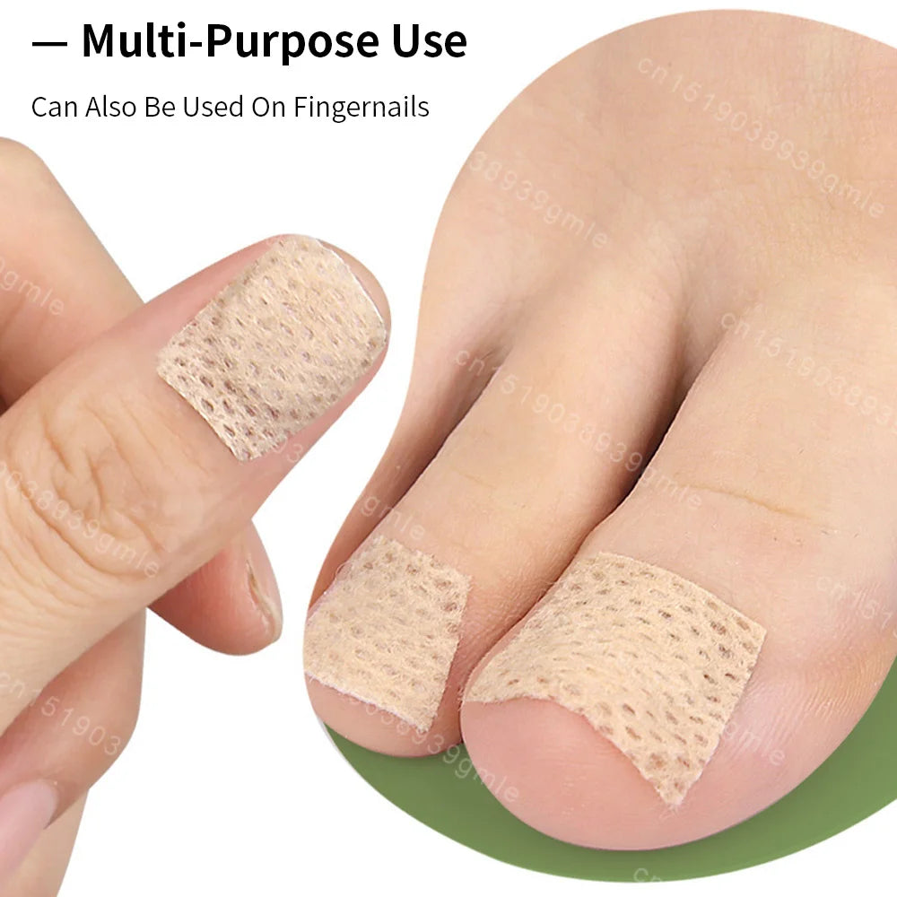 Toenail Fungus Repair Patches | Nail Care for Discolored Nails
