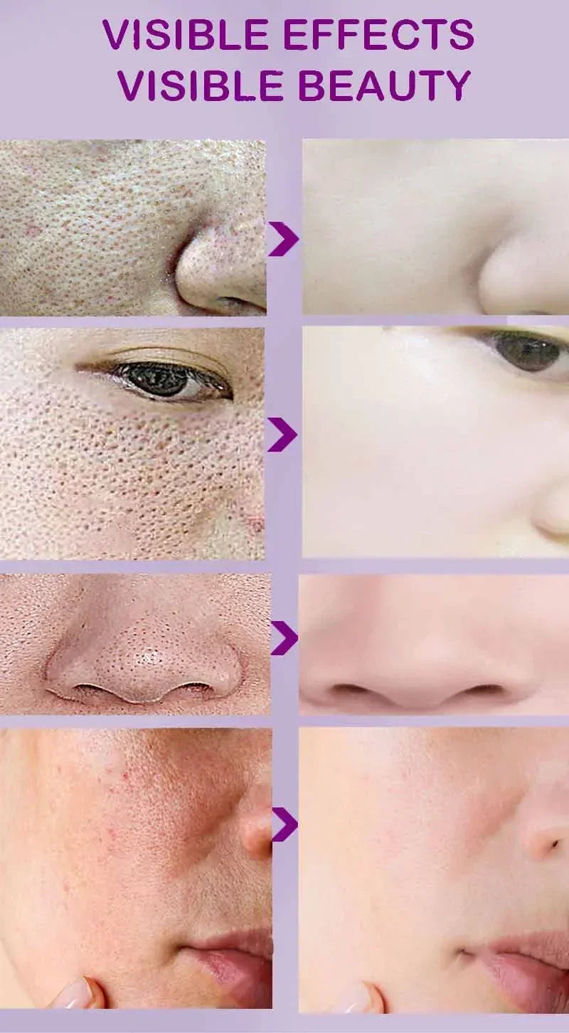 Pore Refining Resurfacing Serum | Brightening Facial Elixir