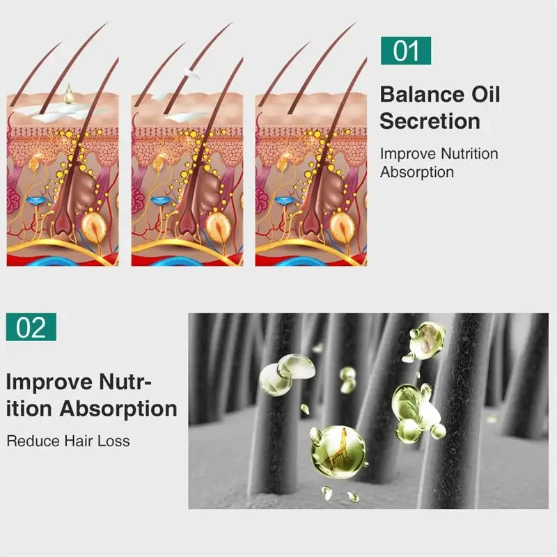 Ginger Hair Growth Essential Oil | Anti-loss Regrowth Serum