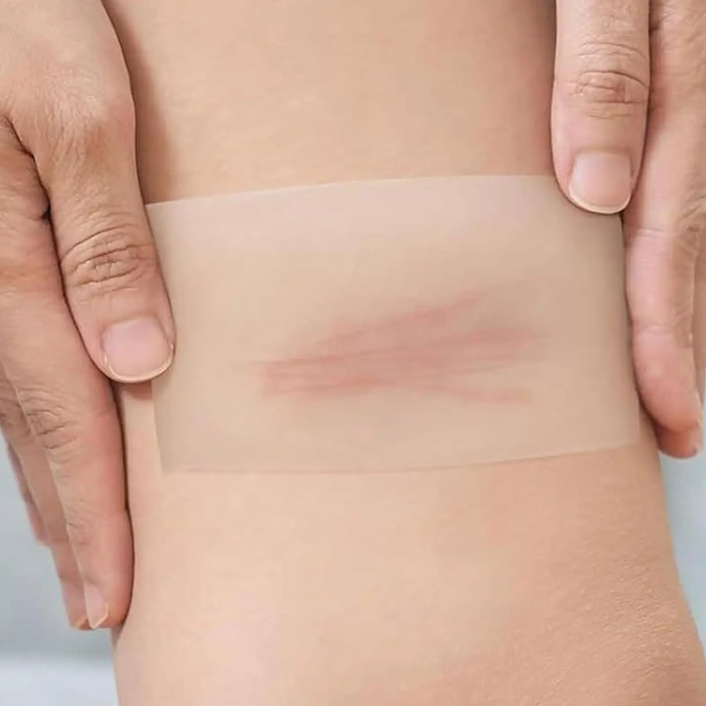 Hydrocolloid Roll Waterproof Pimple Patches | Flexible Skin Dressings