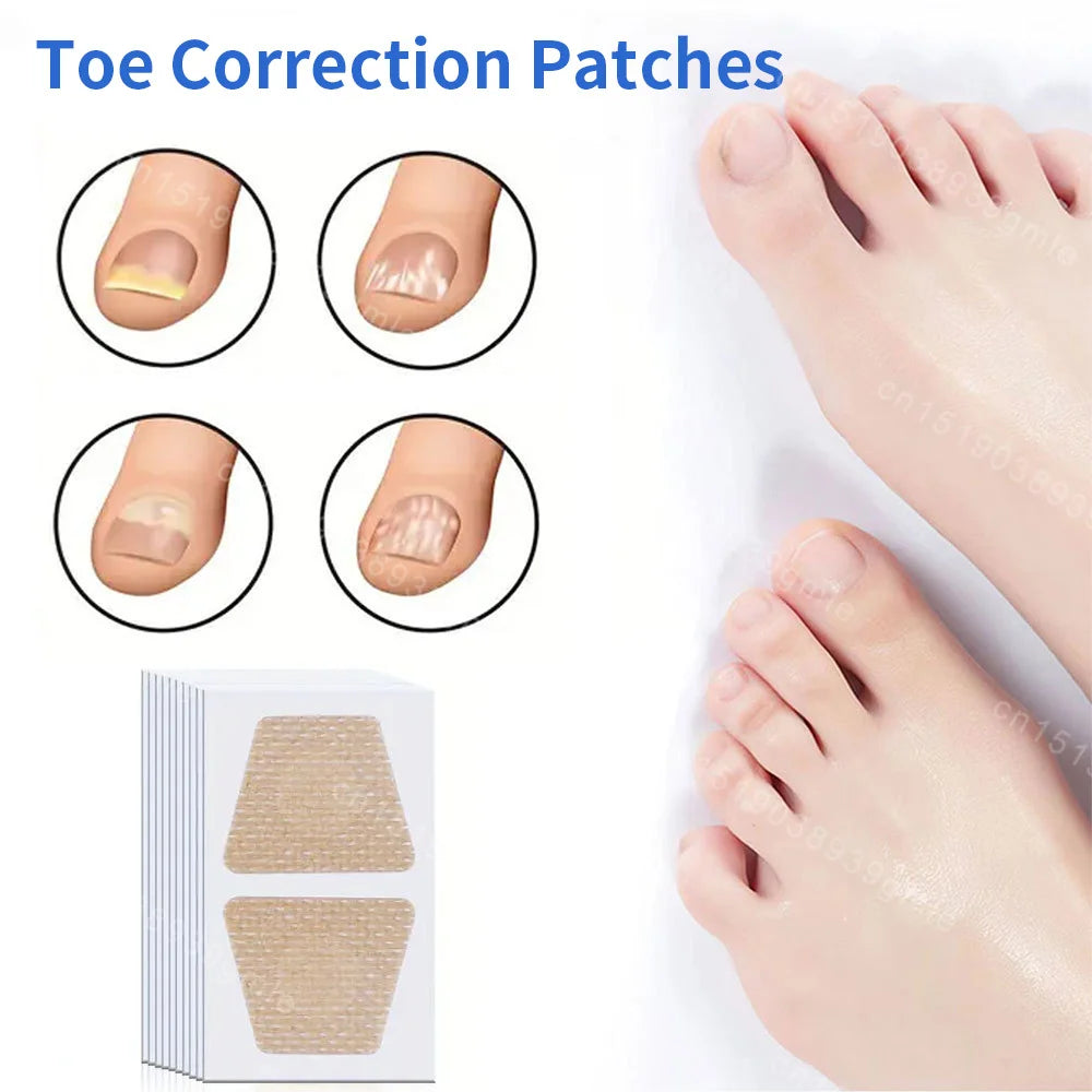 Toenail Fungus Repair Patches | Nail Care for Discolored Nails