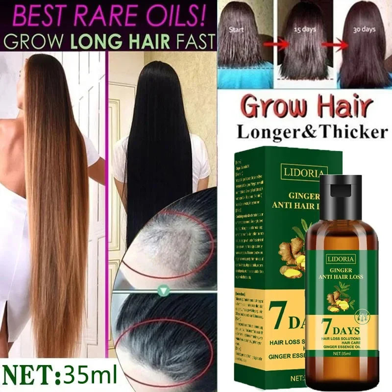 Ginger Hair Growth Essential Oil | Anti-loss Regrowth Serum