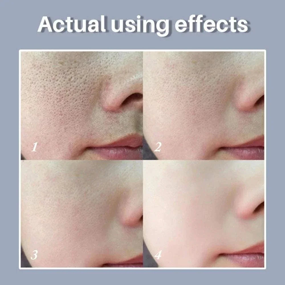 Pore Refining Resurfacing Serum | Brightening Facial Elixir