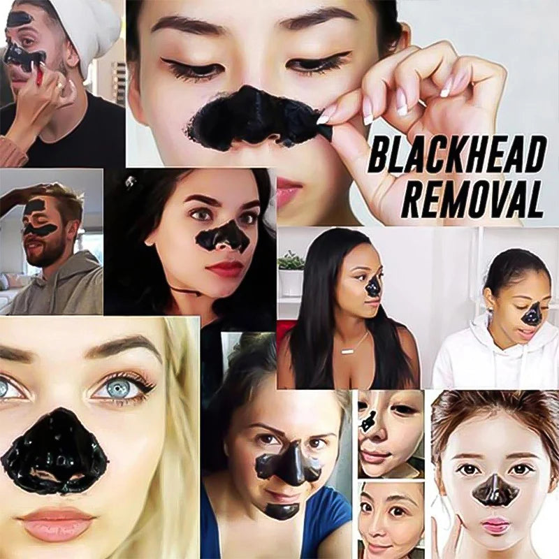 Bamboo Charcoal Blackhead Remover Mask | Pore Shrink & Acne Care