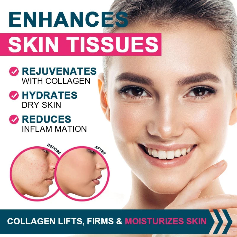 Multiple Collagen Complex for Hair, Skin, Nails & Joint Health