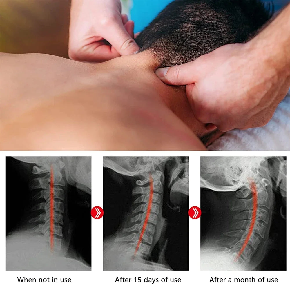 Cervical Traction Device | Neck Stretcher for Pain Relief