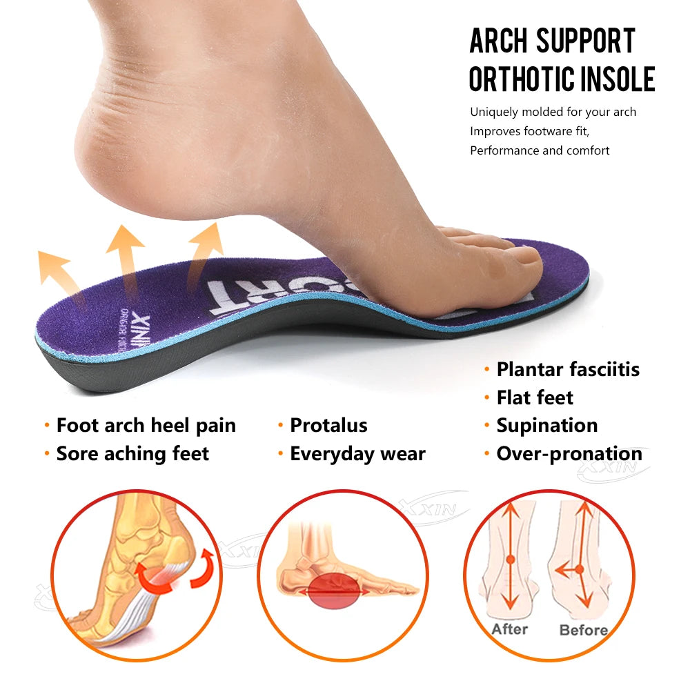 Arch Support Insoles for Flat Feet | Orthopedic Shoe Pads