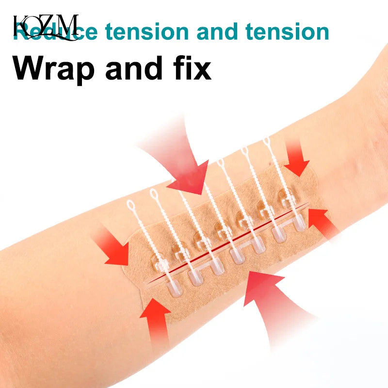 Portable Zipper Tie Wound Closure Patch | Quick Hemostatic Band-Aid