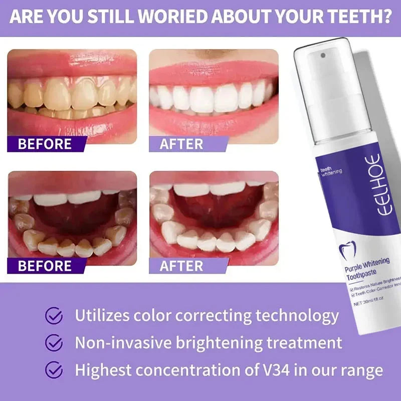 Bestselling Whitening Toothpaste | Brighten Your Smile Naturally