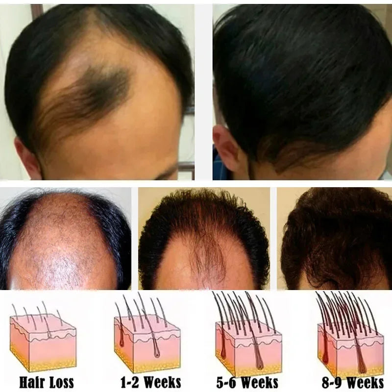 Ginger Hair Growth Essential Oil | Anti-loss Regrowth Serum